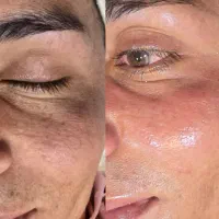 درمان مشکلات پوستی تخصصی