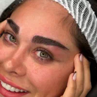 کاشت ابرو بدون جراحی