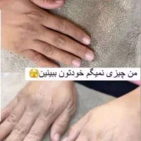 مشاوره تخصصی پوست ومو