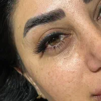 کاشت مژه هیدن