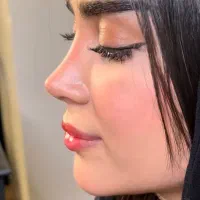 تخفیف عمل بینی لیپو ساکشن ابدو لیفت پروتز پیکرتراش|خدمات آرایشگری و زیبایی|چالوس, |دیوار