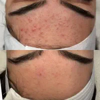 خدمات و آموزش تخصصی فشیال|خدمات آرایشگری و زیبایی|پاکدشت, پاکدشت (مامازند)|دیوار