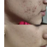 مشاوره محصولات پوست و مو