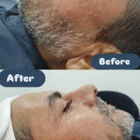 فیشیال صورت خانم ها آقایان