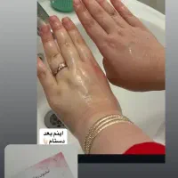 روشن شدن صورت و بدن تضمینی|آرایشی، بهداشتی، درمانی|پارسآباد, |دیوار