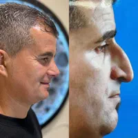 جشنواره عمل بینی فقط با ۲۵ میلیون|خدمات آرایشگری و زیبایی|رشت, رشتیان|دیوار