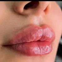 ٪50 آفر مزو prp بوتاکس فیلرلب زاویه سازی فیلر چانه|خدمات آرایشگری و زیبایی|مشهد, وکیل‌آباد|دیوار