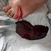 درمان سیاتیک و دیسک،فصدحجامت،ماساژ، طب سنتی آموزش|خدمات زیبایی و سلامت|تهران, دروازه شمیران|دیوار