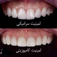 لمینیت و کامپوزیت|خدمات آرایشگری و زیبایی|تهران, پاسداران|دیوار