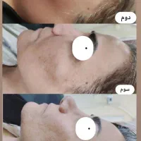 خدمات زیبایی پوست و مو در مطب دکتر شریفی|خدمات آرایشگری و زیبایی|فولادشهر, B5|دیوار