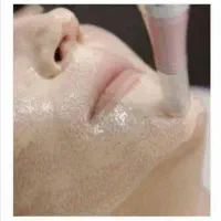 خدمات و آموزش فشیال نیدلینگ کرم پودردائم اسیدتراپی