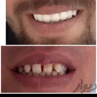 برطرف کردن تمام عیوب دندان|آرایشی، بهداشتی، درمانی|سیرجان, |دیوار