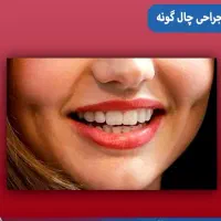 ساکشن غبغب وبوکال فت و چال گونه توسط پزشک در مطب|خدمات آرایشگری و زیبایی|مشهد, شهید فرامرز عباسی|دیوار