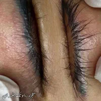 ریموور تخصصی  تاتو با مواد اصل آمریکایی با ضمانت|خدمات آرایشگری و زیبایی|جیرفت, |دیوار