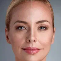 منافز صورت