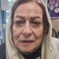لیفت صورت پیشانی گونه شقیقه ابرو گردن