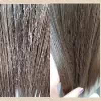 موخوره گیری تخصصی با تخفیف ویژه