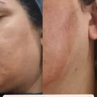 روتین پوستی مهلران|خدمات آموزشی|احمدآبادمستوفی, |دیوار