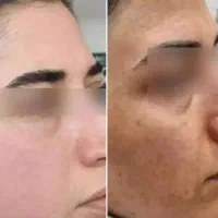 کرم معجزه چهل گیاه عماراتی