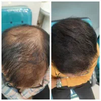 موهاتو قسطی بکار