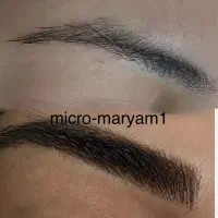 مدل میکروبلیدینگ/شیدینگ لب تخصصی