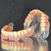 دندانسازی الماس