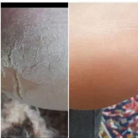 محصولات لدورا