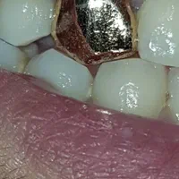 دندانپزشکی انجام تمامی خدمات دندانپزشکی|خدمات آرایشگری و زیبایی|تبریز, |دیوار