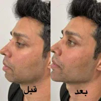 انجام خدمات ژل و بوتاکس و تمامی جراحی ها|خدمات آرایشگری و زیبایی|شهریار, شهریار|دیوار