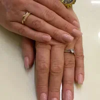 تخفیف ویژه کاشت و ترمیم ناخن