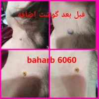 خال وزکیل خانم واقا