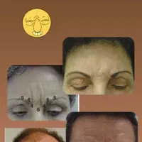فشیال تخصصی تحت نظرپزشک..مشاوره مراقبت های پوست مو|خدمات آرایشگری و زیبایی|آبادان, |دیوار