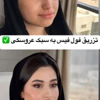 تخفیفات طلایی/ژل لب/ بوتاکس/ گونه/ فول فیس خط خنده|خدمات آرایشگری و زیبایی|مشهد, دانشجو|دیوار