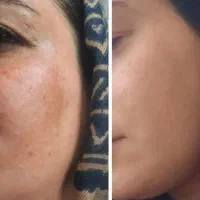 غول ضد لک ۱۵ کاره ایتالیایی شارژ شد