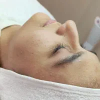 پاکسازی پوست