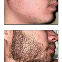 با این پکیج ریشات در میاد