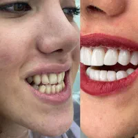 کامپوزیت تخفیف|خدمات آرایشگری و زیبایی|خرم‌آباد, |دیوار