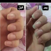 مشاوره درمانی|خدمات آرایشگری و زیبایی|شیراز, حافظیه|دیوار