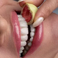 کلیه خدمات دهان دندان ایمپلنت کامپوزیت|خدمات آرایشگری و زیبایی|رشت, گلسار|دیوار