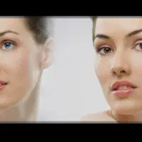 برداشتن خال وزگیل