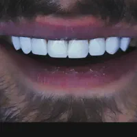 خدمات دندان پزشکی و دندان سازی|خدمات آرایشگری و زیبایی|زنجان, |دیوار