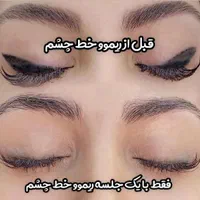 ریموو تخصصی تتو با مواد گیاهی اروپا تک جلسه|خدمات آرایشگری و زیبایی|تهران, دهکده المپیک|دیوار