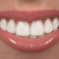 دندان سالم را با ماتجربه کنید اقساطی(دم قسط)|خدمات آرایشگری و زیبایی|راور, |دیوار