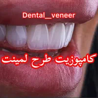 کامپوزیت دندان رایگان  ،لمینت ( اقساط ۱۵ ماه)|خدمات آرایشگری و زیبایی|تهران, الهیه|دیوار