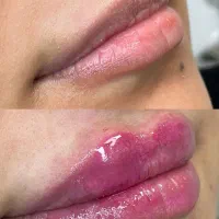 کلینیک زیبایی جراحی ژل بوتاکس غبغب فیلر لیزر مزو