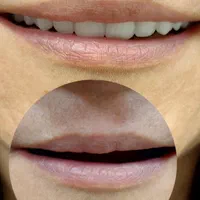 دندانسازی/دندان مصنوعی|خدمات آرایشگری و زیبایی|اندیشه, اندیشه فاز ۱|دیوار