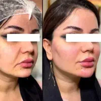 پکیجهای باور نکردنی با کمترین قیمت ژل و انزیم۳۰۰|خدمات زیبایی و سلامت|اهواز, کیانپارس |دیوار