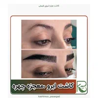 کاشت مو ابرو و ریش تارکوب|خدمات آرایشگری و زیبایی|محلات, |دیوار