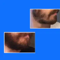 بردپیت شو|آرایشی، بهداشتی، درمانی|تخت سلیمان, |دیوار
