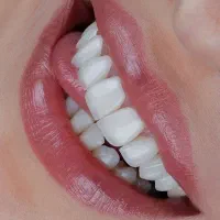 دندانپزشکی اقساطی لمینت درمانی و زیبایی
